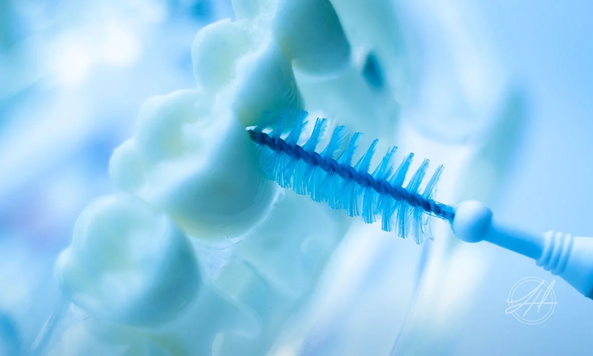 Specialist periodontal treatment